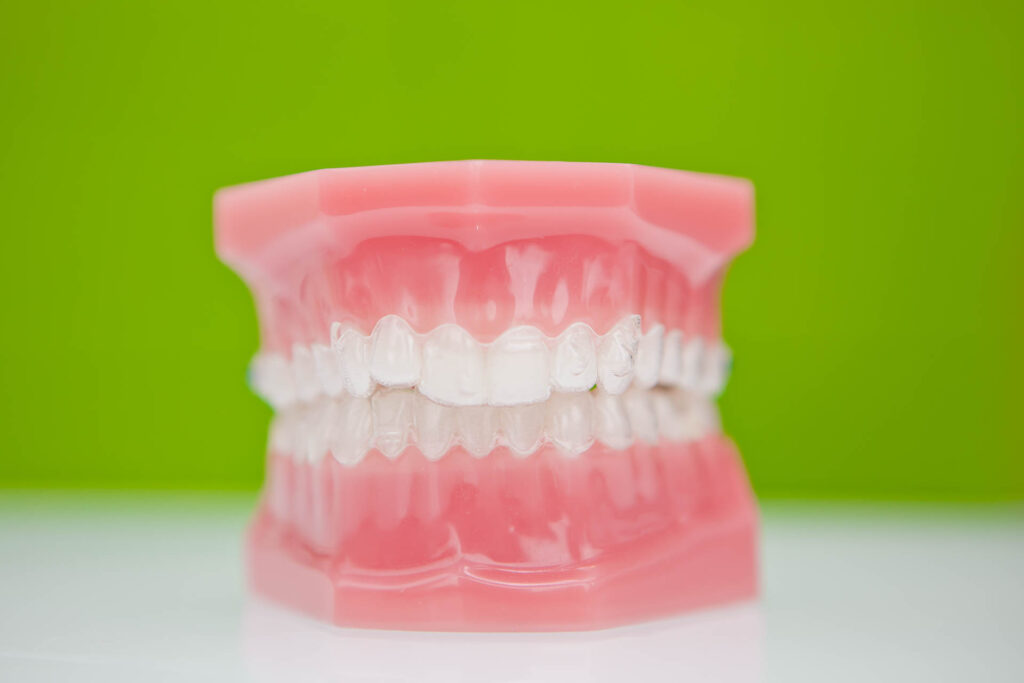 Croydon Teeth Straightening
